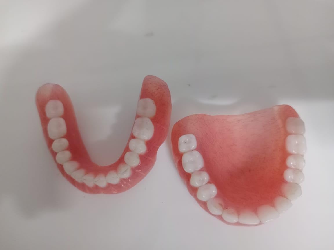 Full Set Upper & Lower Denture A82301