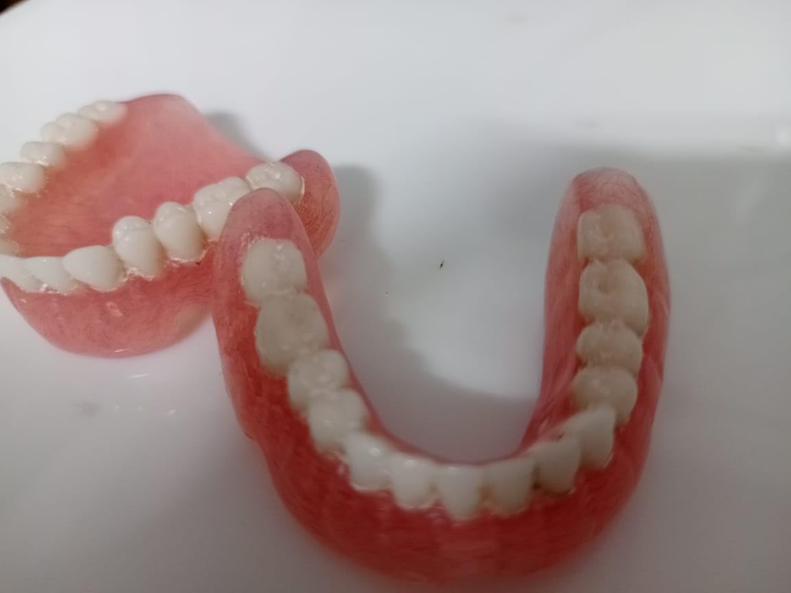 Full Set Upper & Lower Denture A82301
